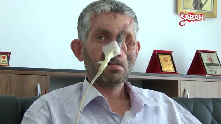 Dişini çektirdi gözünü kaybetti