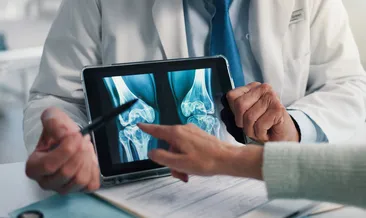 Uzmandan kemik erimesi olarak bilinen osteoporoz uyarısı! Uzun süre belirti vermeden ilerleyebiliyor!