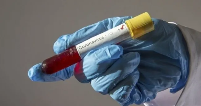 koronavirus test sonucu kac gunde ve ne zaman cikar e nabiz ile covid 19 test sonucu sorgulama nasil yapilir son dakika haberler