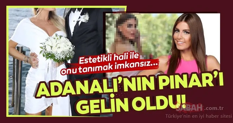 Adanalı dizisinin Pınar’ı Tuğçe Özbudak gelin oldu! Estetikli hali olay olan Tuğçe Özbudak’ı tanımak neredeyse imkansız...