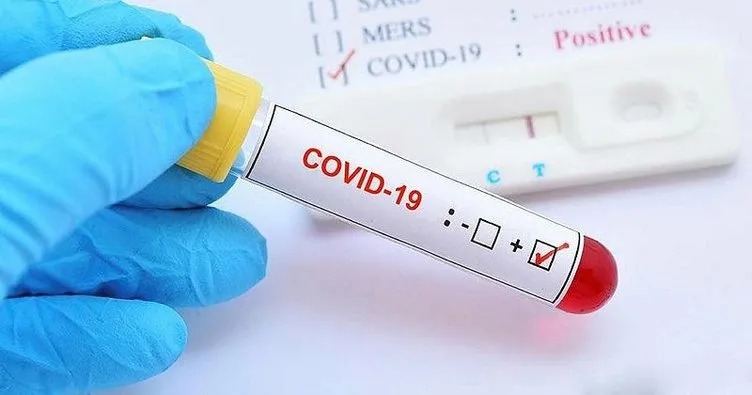 Son Dakika Haberi: Bakan Koca illere göre koronavirüs vaka sayısını açıkladı! Türkiye Covid-19 haritalı vaka sayısı