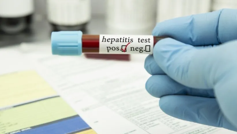 Gizemli hepatit virüsü ile ilgili DSÖ’den endişelendiren açıklama: Küresel bir salgın mı?