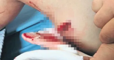 Urla’da küçük çocuğa 3 köpek birden saldırdı