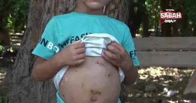 Köpeklerin saldırdığı çocuk 18 gün sonra taburcu oldu | Video
