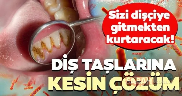 Diş taşlarından kurtulmak için kesin çözüm! İşte doğal yolları...