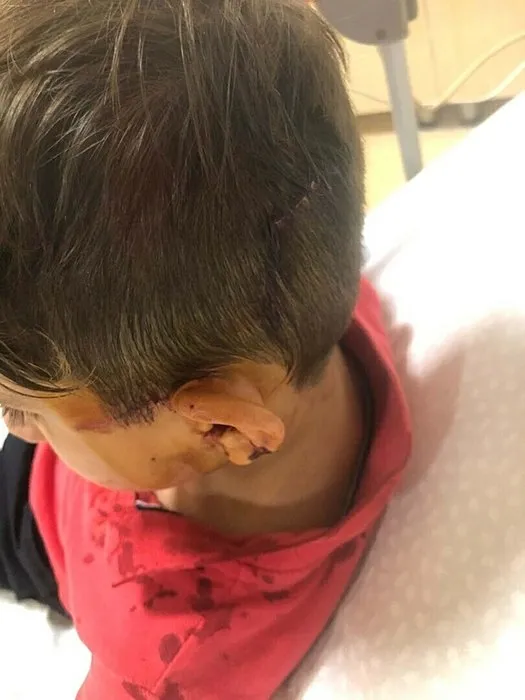 İzmir’de başıboş köpek dehşeti: 6 yaşındaki Baran ölümden döndü!