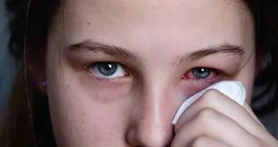 Göz ağrısı ve nedenleri