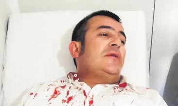 Kravatımla beni boğmaya çalıştılar