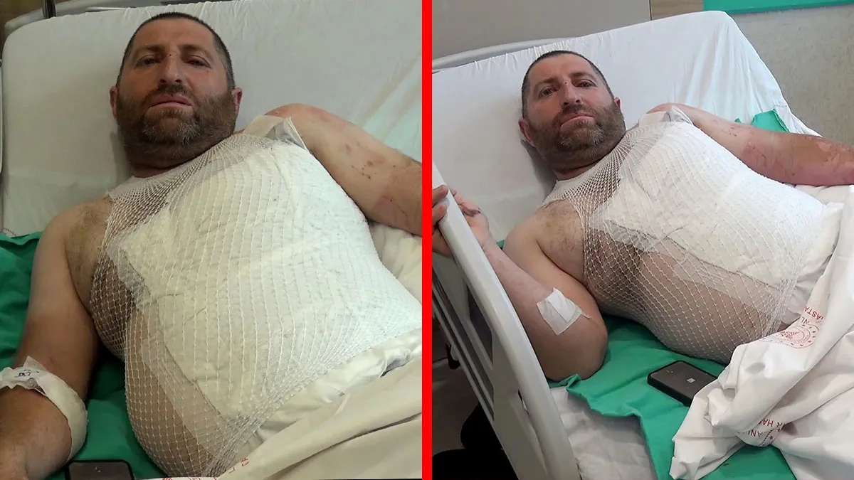Erzincan’da korkunç olay! Elektrik akımına kapılıp metrelerce yüksekten düştü: ‘Tutuşan elbiselerimi söndürüp…’