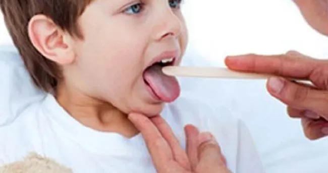 tek tarafli sag ve sol bademcik sismesi