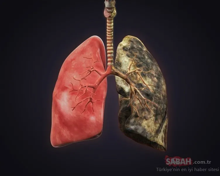 Uzmanlar akciğerleri temizleyen besini açıkladı!  İşte akciğerleri temizleyen en şifalı besin...