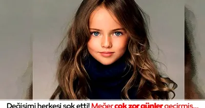 Dünyanın en güzel kızı büyüdü! Değişimi herkesi şok etti, meğer ne zor günler geçirmiş…