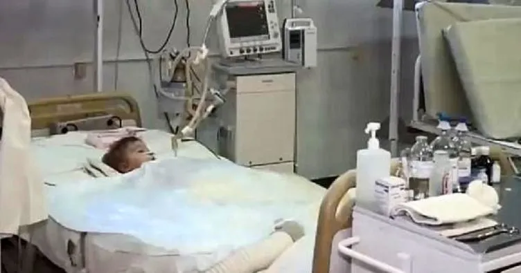 Ukrayna’da 2 yaşındaki bebek doğum gününde köpeklerin saldırısına uğradı
