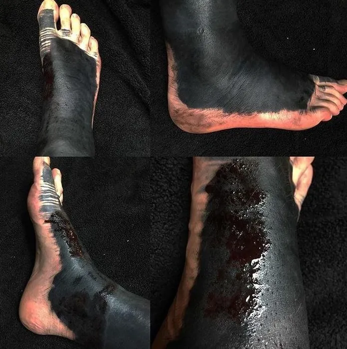 Dövme yaptırdılar sonucu bakın ne oldu!