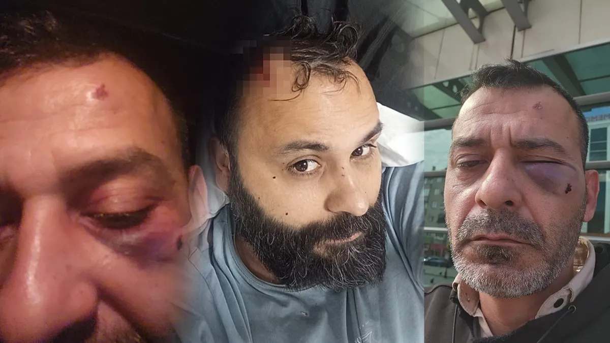 SON DAKİKA… Sosyal medya fenomeni Adem Ocaktan öldüresiye darp edildi! Dehşet anları kamerada: Kafasına 17 dikiş atıldı! SON DAKİKA… Sosyal medya fenomeni Adem Ocaktan öldüresiye darp edildi! Dehşet anları kamerada: Kafasına 17 dikiş atıldı!