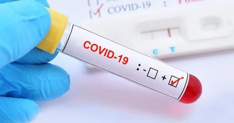 Son dakika: Dünya genelinde yeni tip koronavirüs vaka sayısı 9 milyonu aştı
