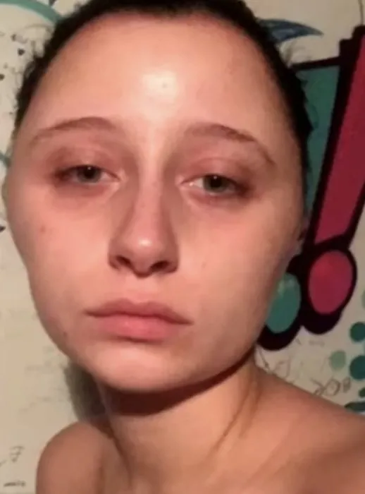Teenager is 'BLINDED for two days after colouring her hair with Garnier nutrisse
