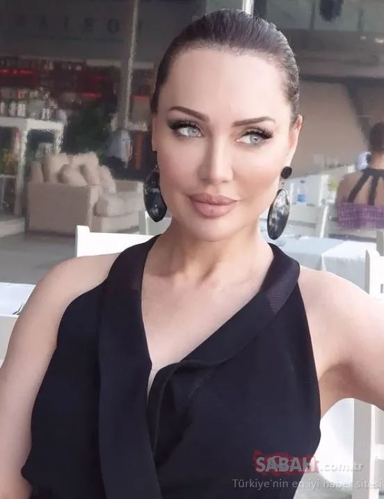 Yerli Angelina Jolie diyorlardı ama… Estetiğin dozunu kaçıran şarkıcı