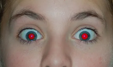 Fotoğraflarda neden gözlerimiz kırmızı çıkar? Ardında yatan neden sizi çok şaşırtacak...