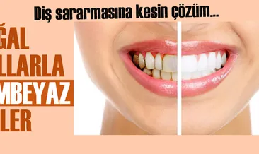 Evde diş beyazlatma yöntemleri