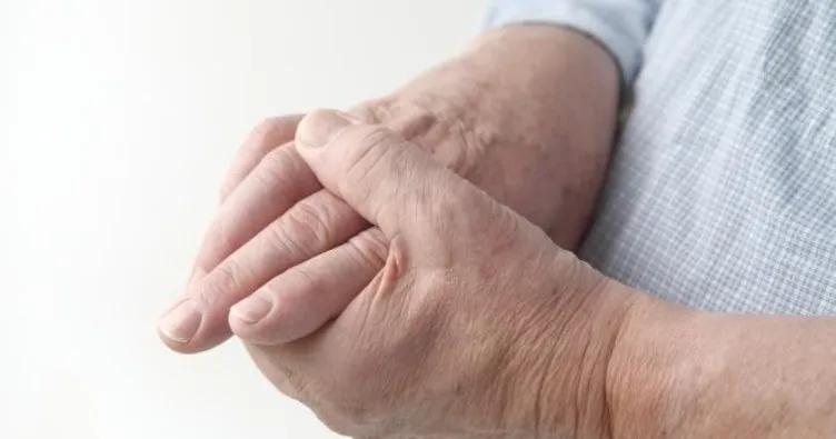 Romatoid artrit hastaları nasıl beslenmeli?
