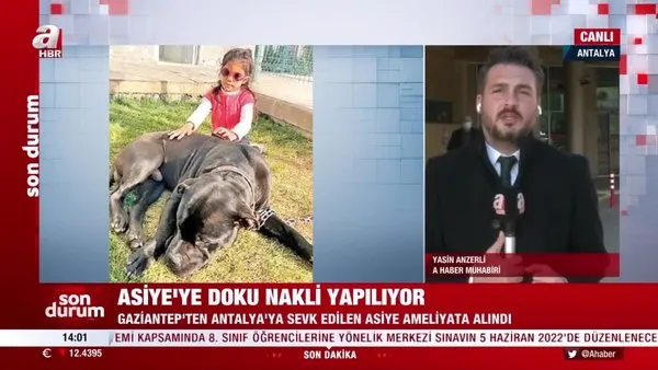 Son Dakika: Gaziantep'te pitbull saldırısında yaralanan Asiye'ye doku nakline başlandı! | Video