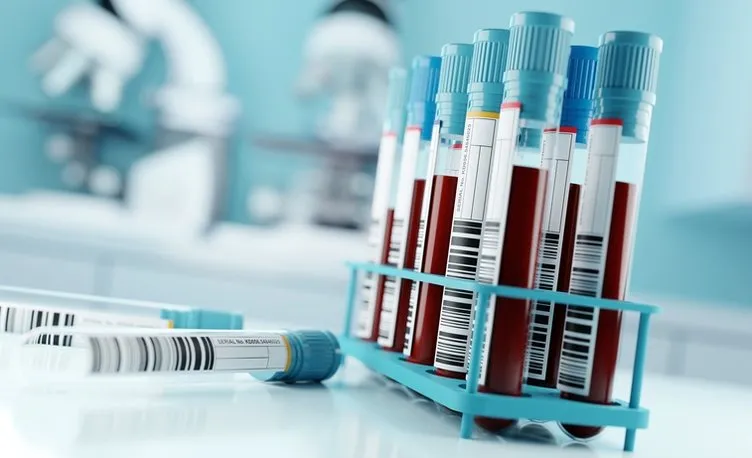 Kanseri yok edecek kan testi geliştirildi! Bilim insanlarından tarihi değiştirecek buluş...