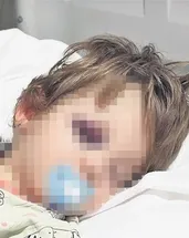 Baba ve 14 aylık kızına vahşi saldırı