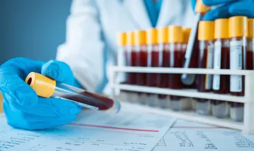 Kan tahlilinden Alzheimer teşhisi! Bilim dünyasında çığır açan keşif