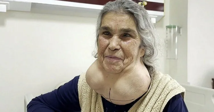 50 yıldır doktor korkusundan hastaneye gitmedi, 2 kiloluk kitleyle yaşadı