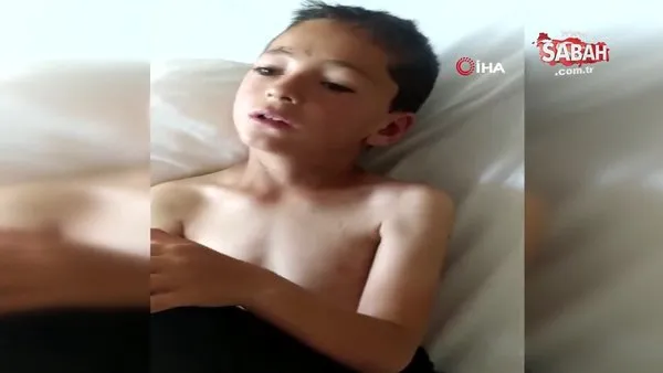 Ankara'da 8 yaşındaki çocuğa köpek saldırdı | Video