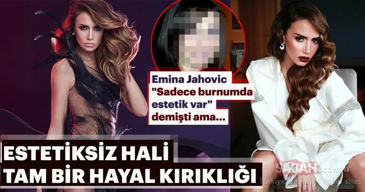 Emina Jahovic Sadece burnumda estetik var demişti ama…