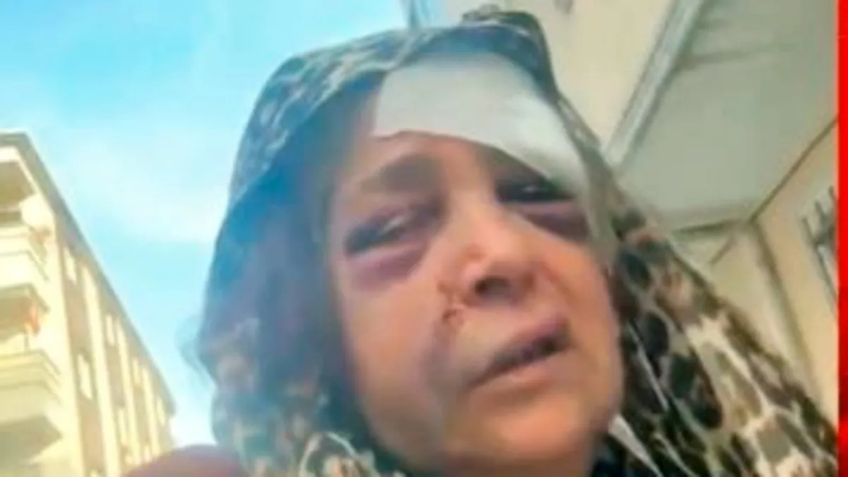 Kızını vuran damadını öldüren kayınvalideyi komşuları alkışlarla karşıladı Kızını vuran damadını öldüren kayınvalideyi komşuları alkışlarla karşıladı