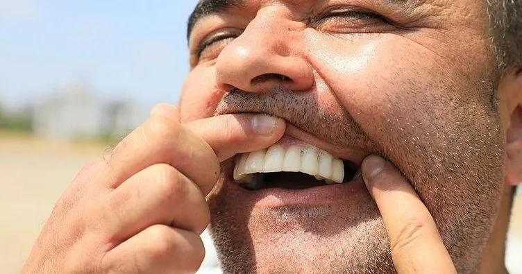Diş hekimini darbettiği iddia edilen hasta: Kafama ve yüzüme yumruk attı