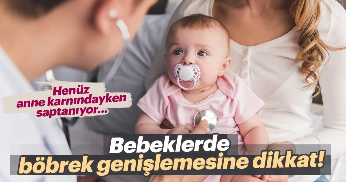 bebeklerde bobrek genislemesine dikkat bebek haberleri