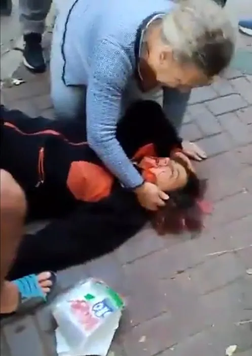 Başıboş köpeklerin saldırısına uğrayan akademisyen Meliha Yılmaz korku dolu anları anlattı: Her biri bedenimden parçalar koparmaya başladı…