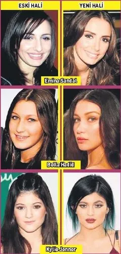 kylie jenner estetikli ve estetiksiz