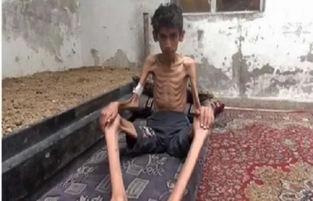 Suriye’nin Medaya kasabasında 40 bin kişi açlıktan ölüyor