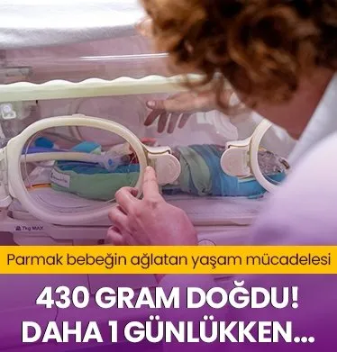 430 gram doğdu: 1 günlükken kalp ameliyatı oldu! Parmak bebeğin ağlatan yaşam mücadelesi