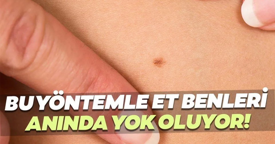 Bu Yontemle Et Benleri Yok Oluyor Saglik Haberleri