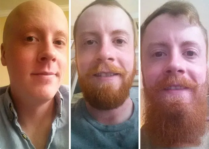Erkeklerin sakalla inanılmaz değişimi