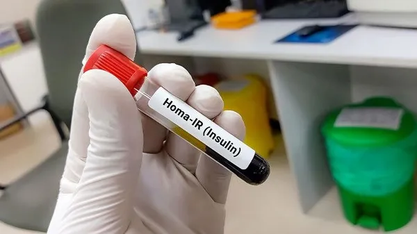 sismanligin-gizli-direktoru-insulin-1782831522896.jpeg