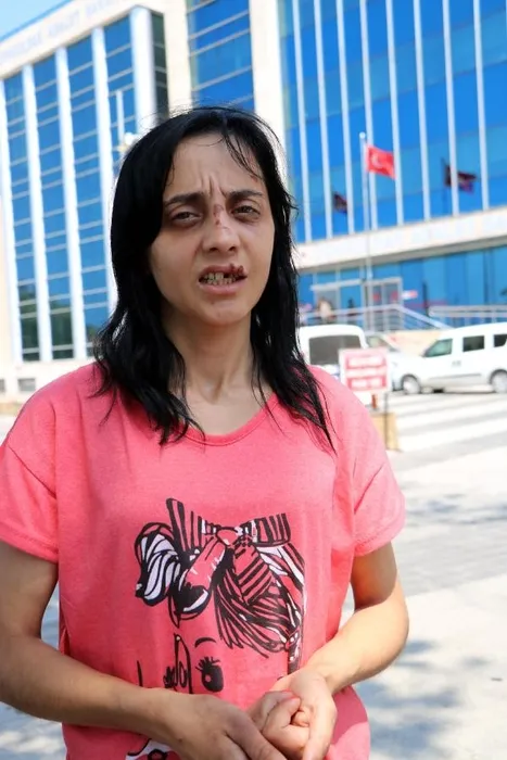 Genç kadına sokak ortasında dehşeti yaşattı! Saldırganın ifadesi pes dedirtti: Tanımıyorum...