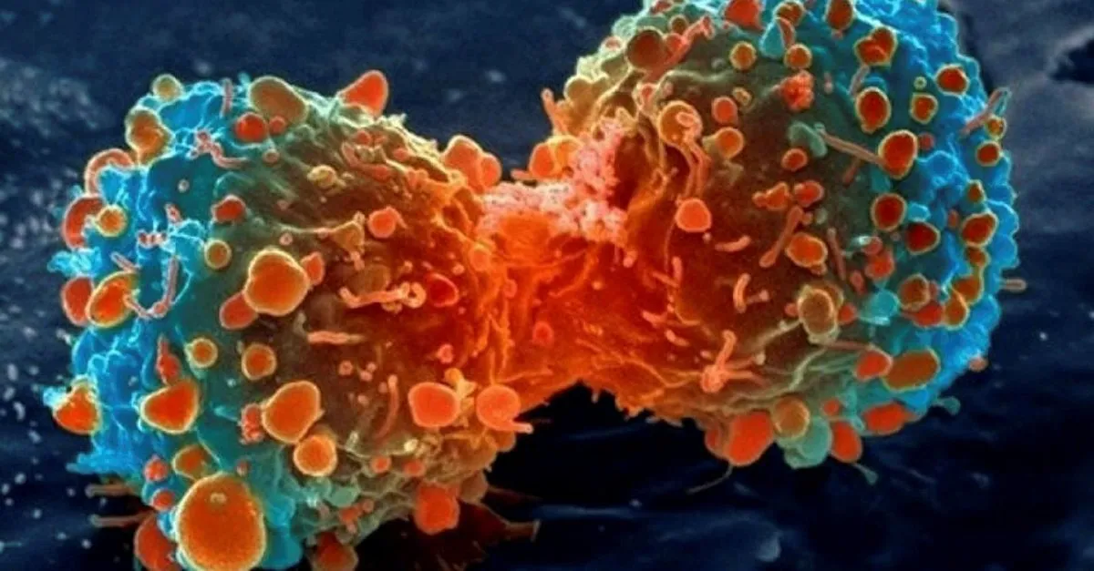 rahim iltihabi nedir belirtileri