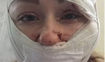 Son dakika: Falçatalı dehşet! Ukrayna uyruklu eşinin yüzünü falçatayla parçaladı! O skandalda flaş gelişme