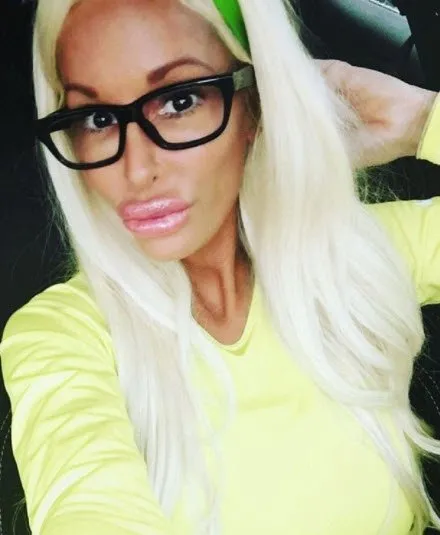 Barbie gibi olmak için akılalmaz yöntemlere başvurdu!