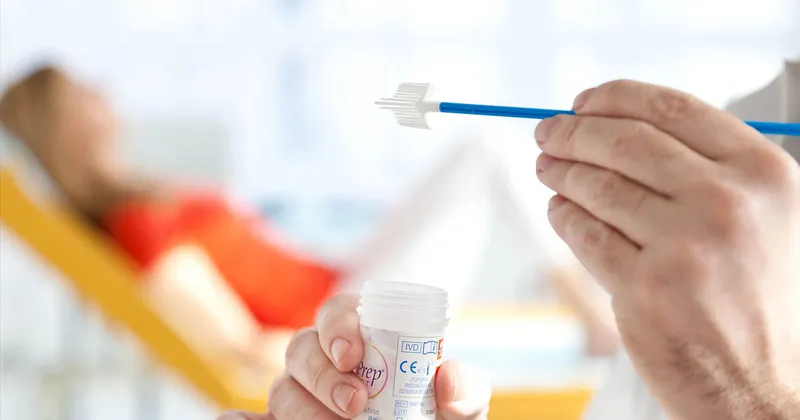 Smear Testi Nedir Ve Nasil Yapilir Saglik Haberleri