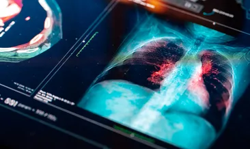 Elektronik sigara kullanımındaki korkunç tablo! Uzmanı uyardı: 5 yaşındaki çocuğun elinde gördüm