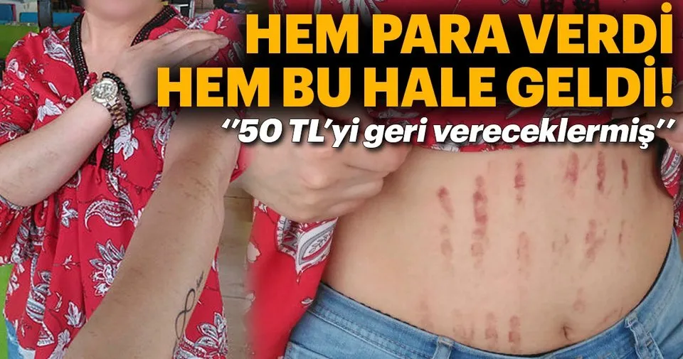 Lazer Epilasyon Ve Para Iadesi Sikayetleri Sikayetvar