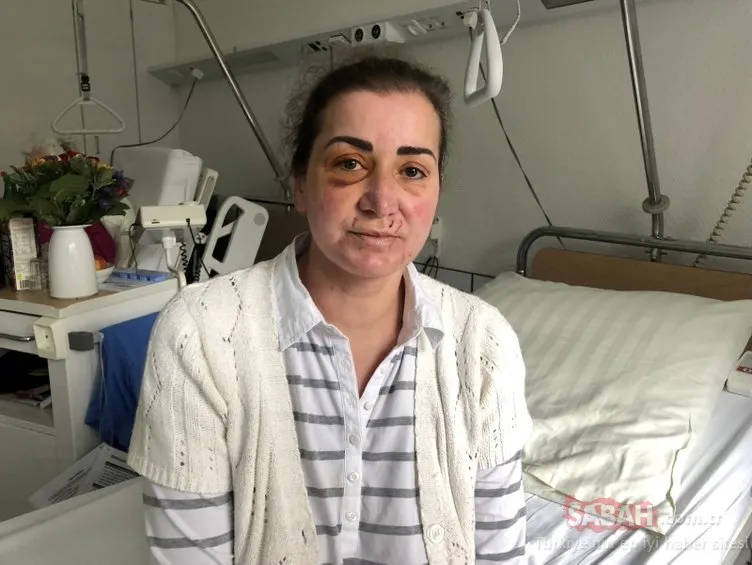 Türk kadına tramvayda ırkçı saldırı